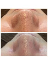 ピュアトゥルー 岐阜西店(PureTrue)/アクアピール