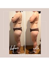 バンブー B2 新涯店(Bamboo)/メラメラダイエットコース