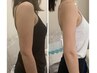 【デトックス痩身】脂肪冷却×超音波×次世代EMS各5回＋酵素348,000→98,000