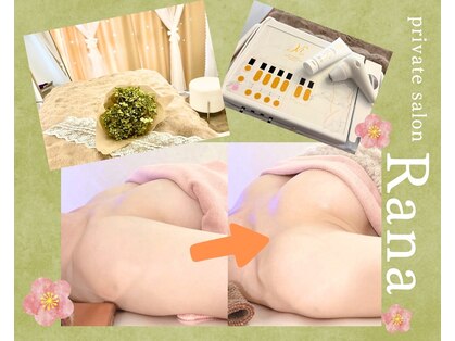 ラナ(Rana)の写真