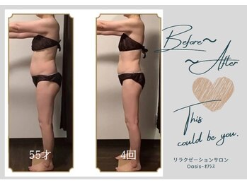 オアシス(Oasis)/side