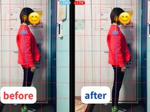 オンリー整体院(ONLY整体院)/befre aftter【桂　整体】