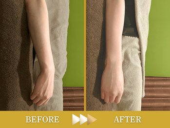 ビアンカ 目黒本院(Bianca)/疲労の蓄積で伸び切らない肘★