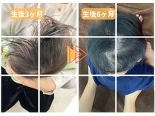 ラフィング(Laughing)/赤ちゃん整体