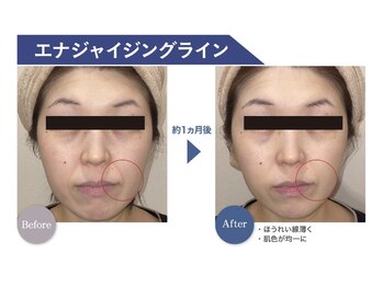 リノア 堀江(Linoa)/FAITH エナジャイジング