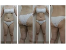 ウノプリール 梅田ハービスプラザ(uno pulir)/<エンダモロジー　body>