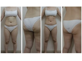 ウノプリール 梅田ハービスプラザ(uno pulir)/<エンダモロジー　body>