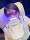 オベリオ(OBERIO)の写真/【歯のセルフホワイトニング】歯の美しさで清潔感＆第一印象UP♪オシャレは口元から♪