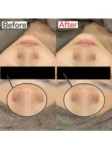 ビーブルーセブン(B.BLUE7)/【最新ハイドロヴィーナススパ】