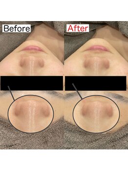 ビーブルーセブン(B.BLUE7)/【最新ハイドロヴィーナススパ】