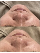 ココカラ(COCOKARA)/毛穴の黒ずみスッキリ！