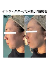 サラ/ブライダル