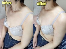 スノードロップ(snowdrop)/バストアップ６ケ月コース