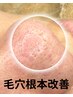 学割U24【いちご鼻撃退】悩みの根本ケア￥10,000→￥3,000男女OK