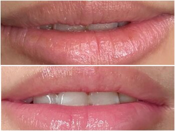 ピンクアンドプラウドサロン 横浜(Pink& Proud Salon)/ローマピンク【唇】