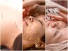 【3週間以内限定◆全身鍼灸×小顔矯正×美容鍼】ご褒美コース110分￥16000→