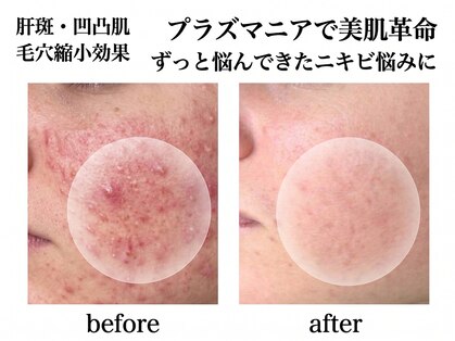 イノエ(inoe)の写真