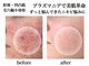 イノエ(inoe)の写真