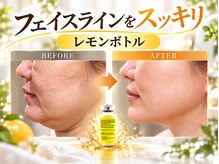美活ラボ(美活LABO)の雰囲気(フェイスラインのもたつきをスッキリ。レモンボトルで細胞分解)