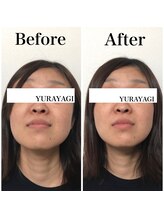 小顔屋ゆらやぎ/頭蓋骨小顔矯正レタッチフェイス