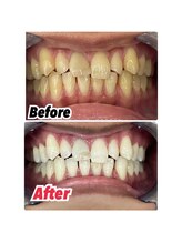 ホワイトニングスタイル 柏店/芸能人レベルの白さ！