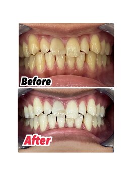 ホワイトニングスタイル 柏店/芸能人レベルの白さ！