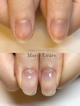 マリーロール 梅田店(Marie Laure)/自爪育成/深爪矯正/ネイルケア