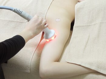 ベルフィーヌ 恵比寿店(BELFINE)/ほっそり二の腕