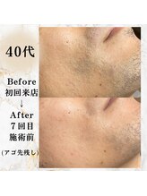 コミチ(KOMICHI)/ビフォーアフター