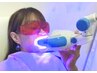 【歯】セルフホワイトニング/Myボトル購入コース(1回照射2セット込み)