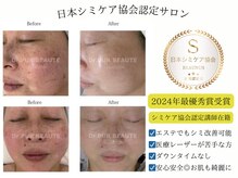 ビューナス(BEAUNUS)