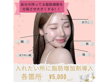 リレイス(Relace)の写真