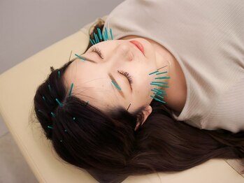 にしもと整骨院 鍼灸院 鶴橋院/EMS美容鍼