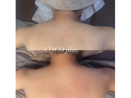 ココプラス 麻布十番(COCOplus)の写真