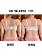 エミニナル(EMININAL)/【背中コルギ】ビフォーアフター