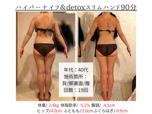 メイリー(MEILLI)/セルライトとさようなら☆