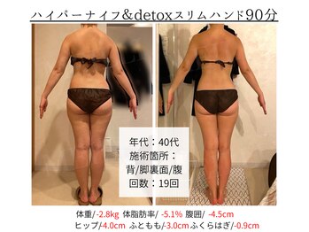 メイリー(MEILLI)/セルライトとさようなら☆