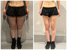 スイッチボディ 岡山駅前店(SWITCH BODY)/2ヶ月で美脚に大変身♪