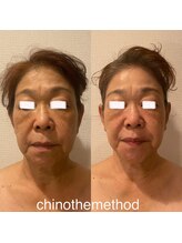 エミナル(EMINALu)/たるみケアも小顔で