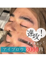 フラン(franc)/
