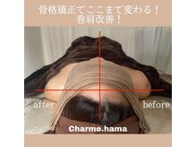 シャルム(Charme.)/骨格矯正+頭蓋骨矯正(症例写真)