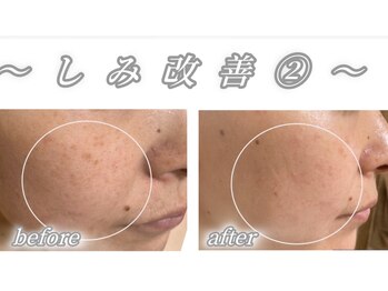 サロンデュ ひゃーく(Salon du ひゃーく)/～お悩み相談～