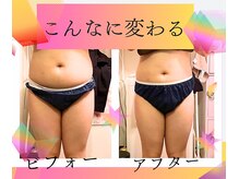 ヨサパーク こあな(YOSA PARK)