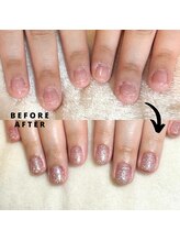 プラスワン(+1)/ハンド深爪矯正