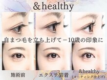 まつげ屋リュ( Ly)/アンドヘルシー