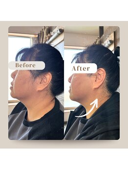 ナギスポット(Nagispot)/