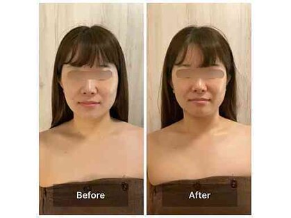 パピヨン(papillon)の写真