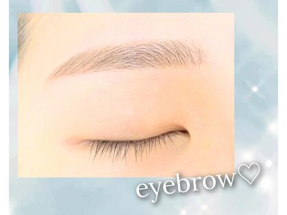 ファンシーウィンク(fancy-wink)の写真