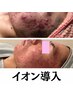 【再来/フェイシャル1ヶ月以内割有】全顏3D毛穴洗浄+イオン美容液導入