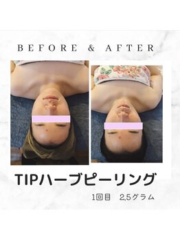 エステティックシトラス(esthetic CITRUS)/before & after
